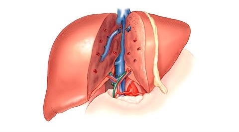 Liver Transplant & HPB Surgery